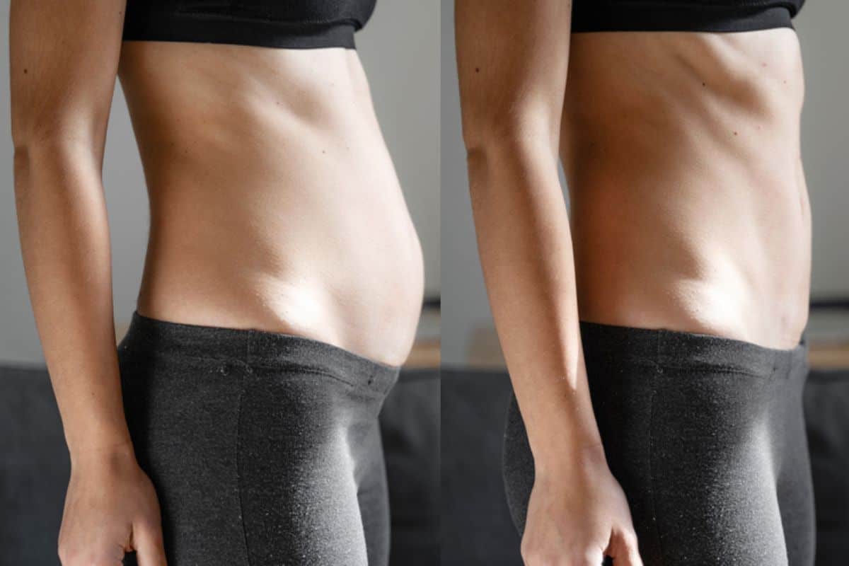 Post-Pregnancy: What Happens to Your Abdominal Muscles After Birth Leytonstone
