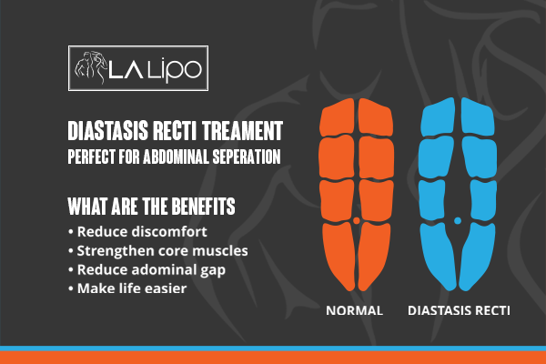 When Should You Consider Professional Help for Core Recovery Leytonstone