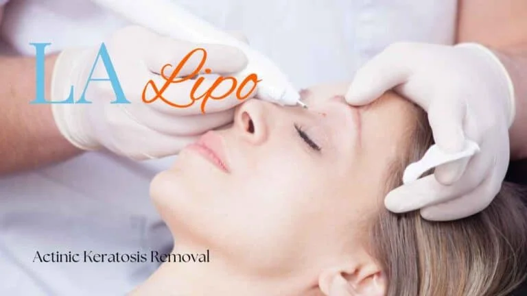 Woman receiving Actinic Keratosis Removal Treatment Leytonstone