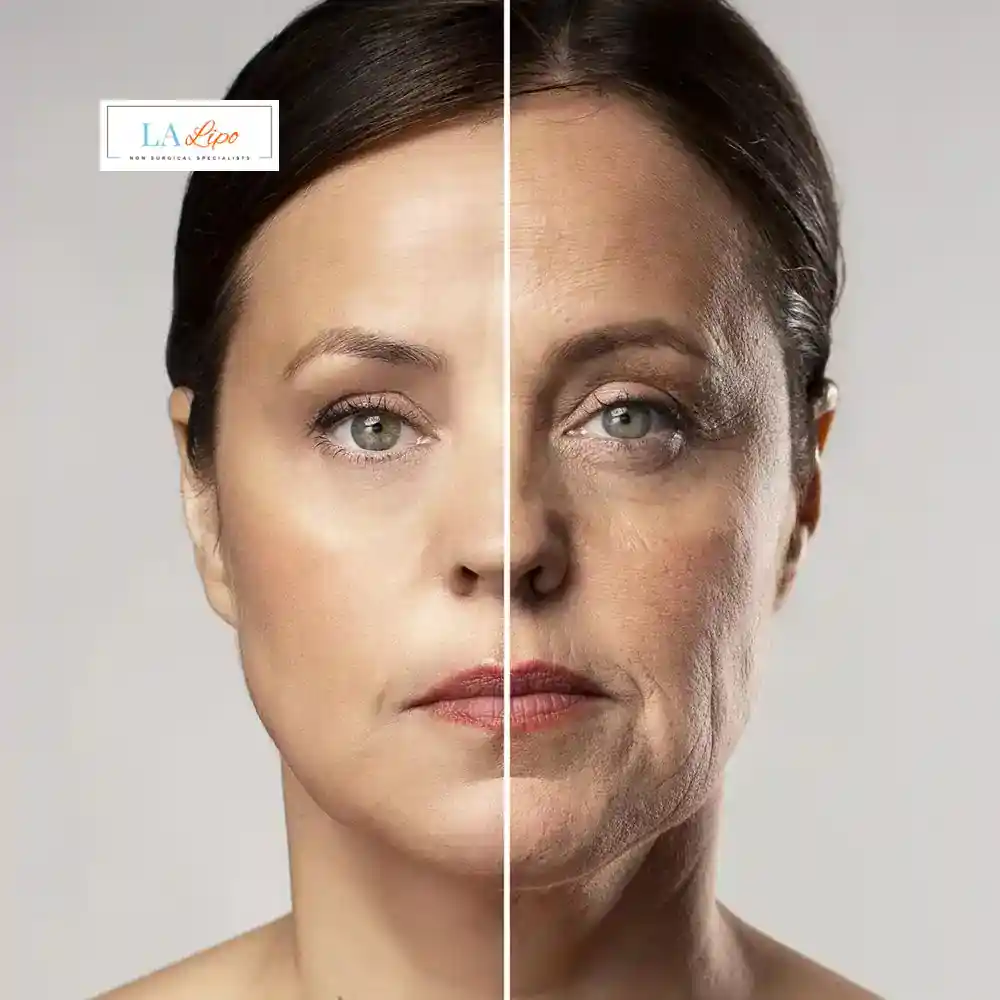 How Can You Tell If Non-Surgical Skin Tightening Is Right for You Leytonstone?