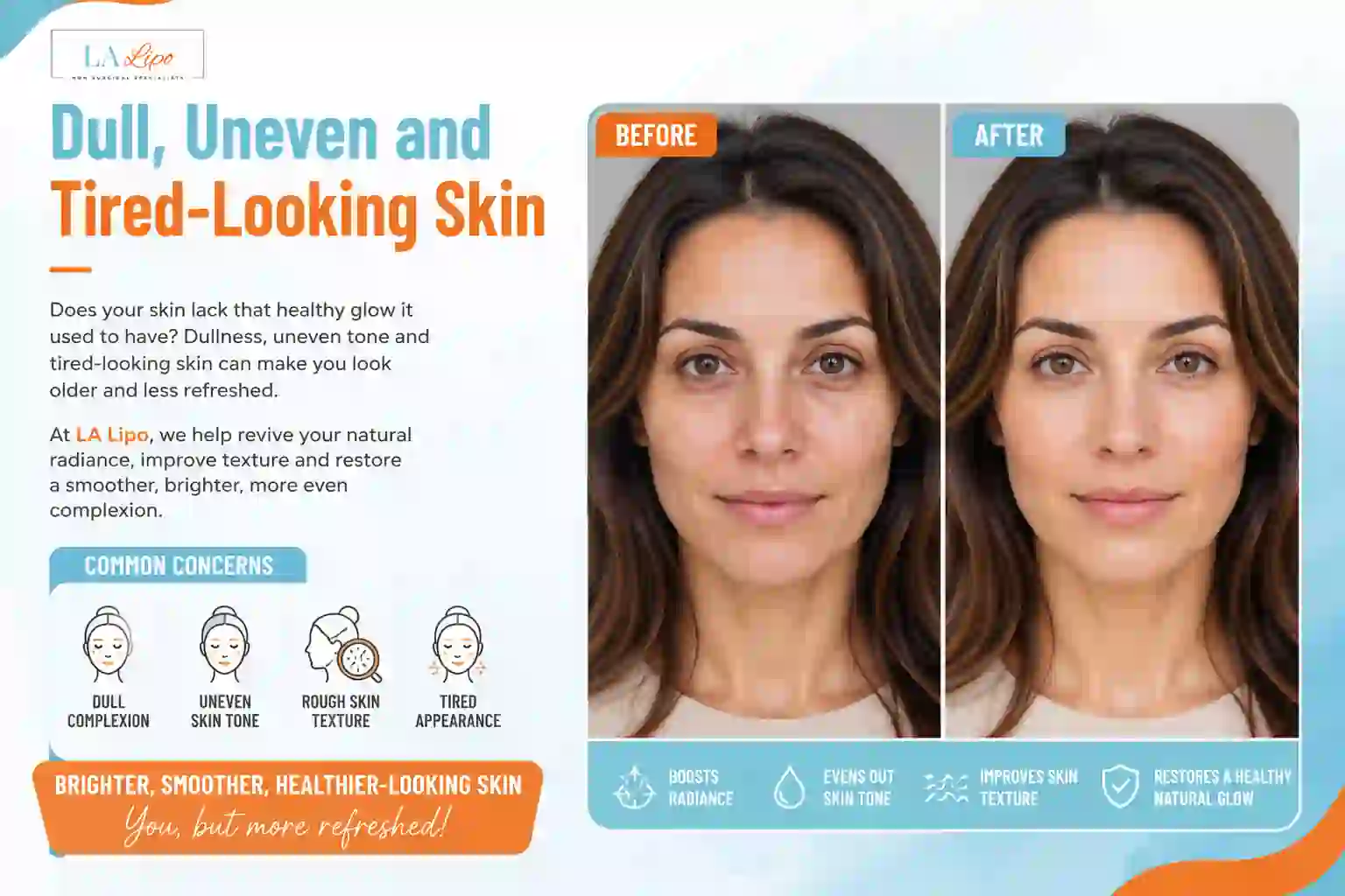 Sign #5: Dull, Uneven and Tired-Looking Skin Leytonstone