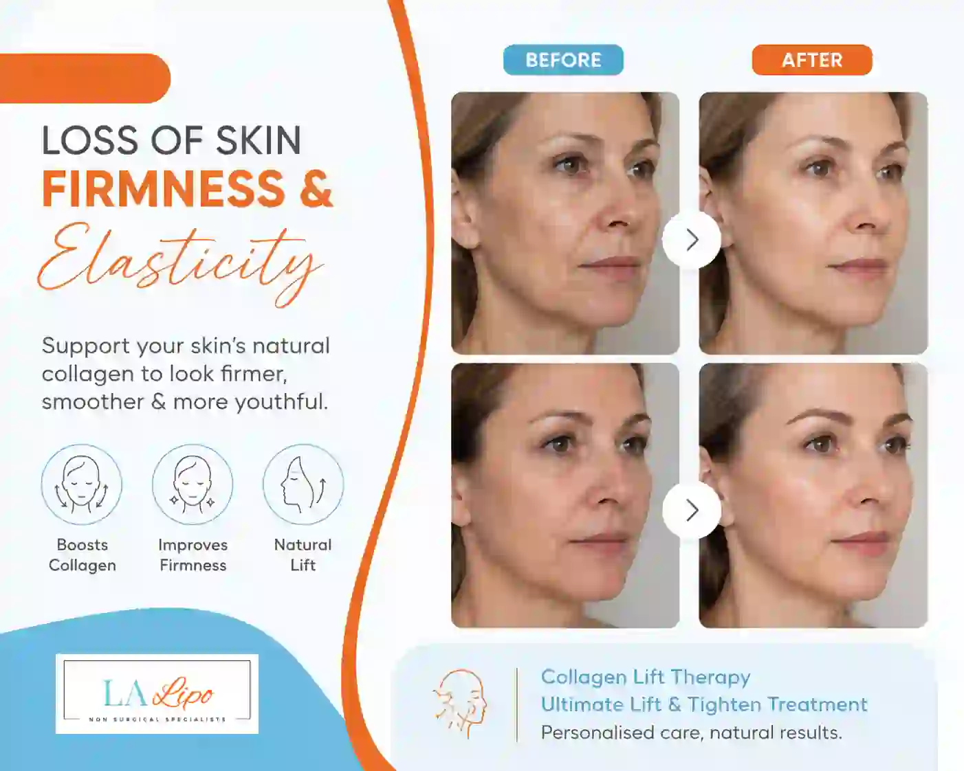 Sign #7: Loss of Skin Firmness and Elasticity Leytonstone